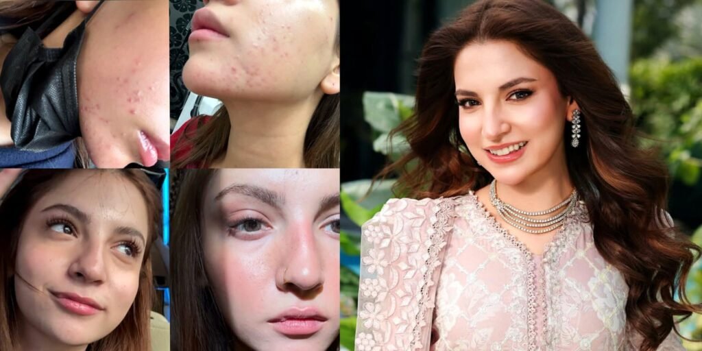 سوشل میڈیا پر خوبصورتی کے معیار پر دانیانر مبین کا بڑا پیغام